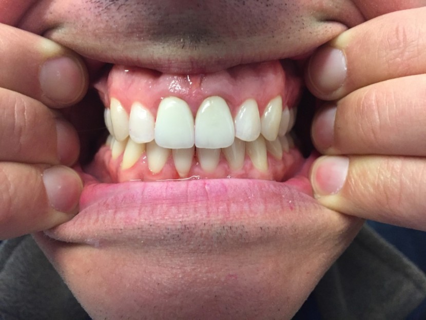 the essence performed well, as you can see.