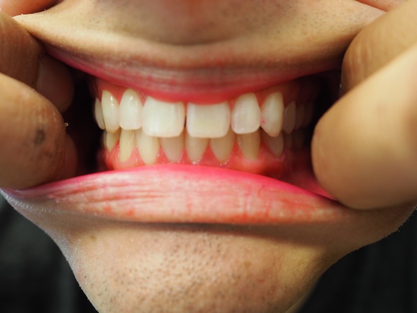 do you think the healthywhite+ made these whiter?