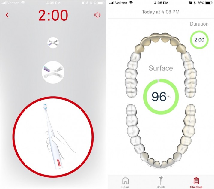 colgate smart electronic toothbrush e1 - the start and finish screens of a coaching app. this coach shows...