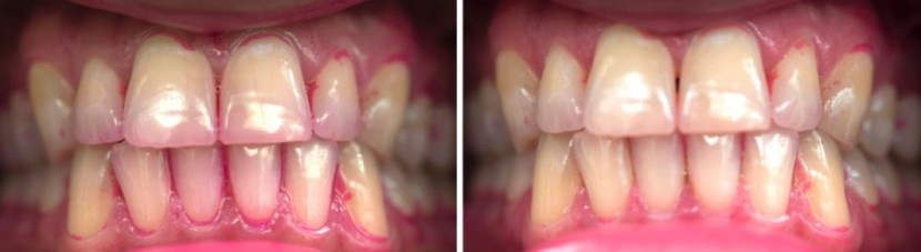 waterpik complete care 9.5 - we weren&#039;t too impressed with the waterpik&#039;s performance.