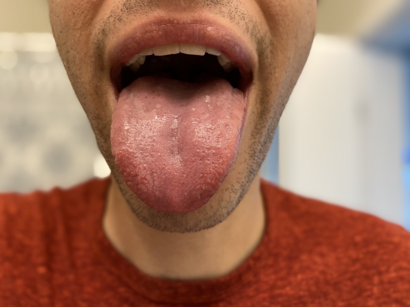 mouthwash - a lot of bad breath can be caused by tongue bacteria, so it's...