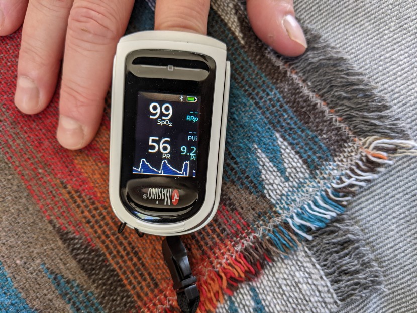 pulse oximeter - the masimo mightysat provides more information than any other device...