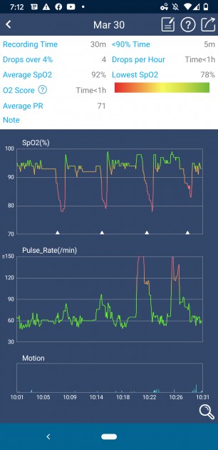 the vihealth app also charts continuous readings that are easy to...