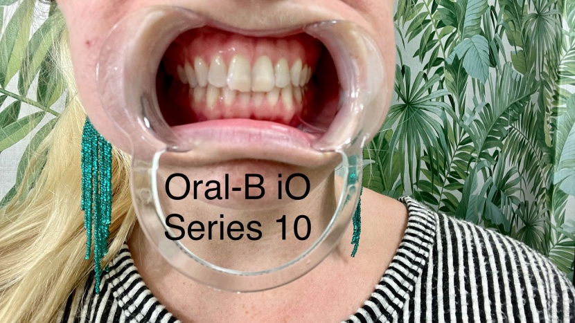 after brushing with the series 10.