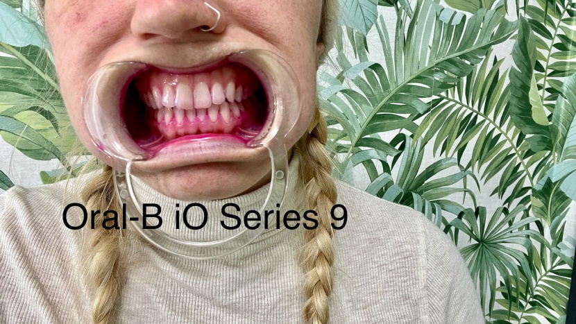 before brushing with the oral-b io series 9.