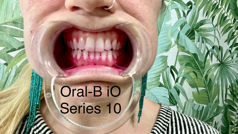 before brushing our teeth with the series 10.