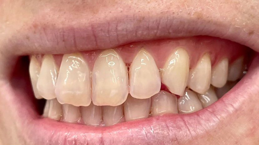 we still noticed hints of pink in between our teeth after using the...