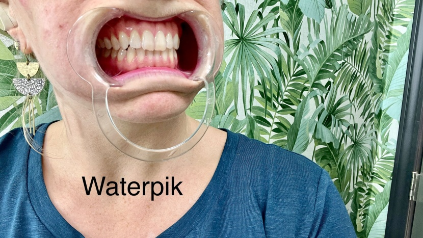 this is how our testers teeth looked after brushing and flossing...