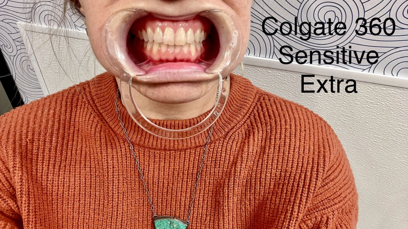 the results after brushing with the colgate 360 sensitive extra soft.