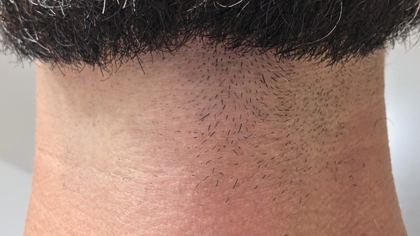 beard trimmer - the philips norelco oneblade offered superior shaving precision...